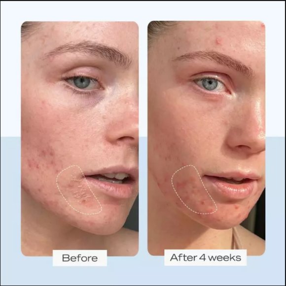 🔥3/$30 NEW FIRST AID BEAUTY FAB Ultra Repair Cream Intense Hydration Dry Skin - Picture 3 of 5